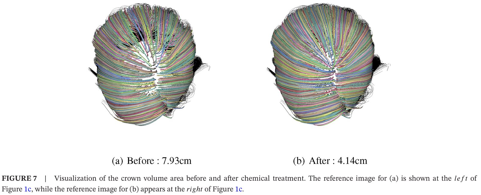 A 3D Visual Tool for Analyzing Changes in Hair Volume and  Length Caused by Medications 이미지